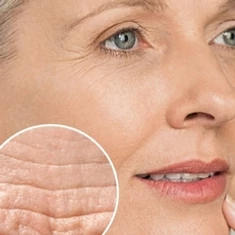Idősődő bőr, anti-aging