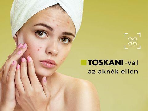 Toskanival az aknék ellen