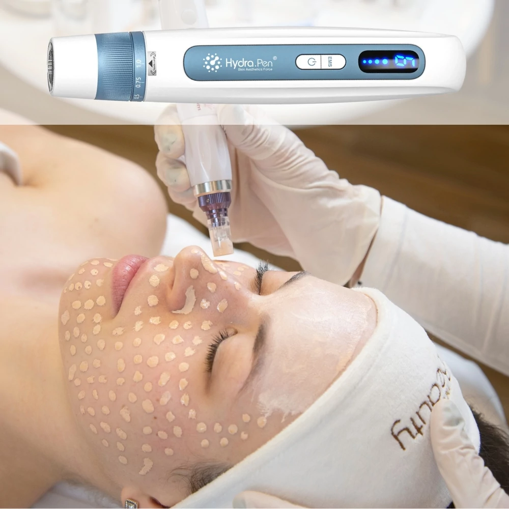 Hidrapen H5 fehér készülék + Organikus Ecuri BB Glow és hidrapen tanfolyam + hatóanyag tanfolyam nano modullal